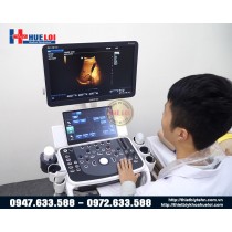 Máy siêu âm Mindray DC 70 Exp